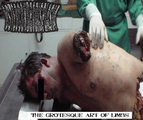 Osteocondrodisplasia : The Grotesque Art of Limbs